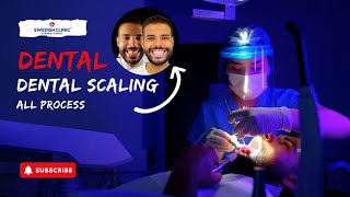 Dental Scaling All Process [upl. by Enyehc]