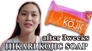 NAKAKAPUTI NGA BA AFTER 3WEEKS REVIEW HIKARI ULTRA WHITE KOJIC SOAP [upl. by Chernow607]