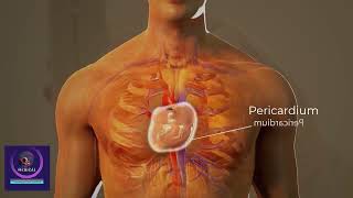 Cardiac Tamponade Treatment  Cardiac Surgery Procedure 3D Animation [upl. by Marcelline]