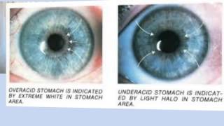 stomachzoneiridology [upl. by Anelliw527]