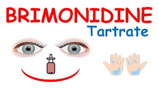 Brimonidine tartrate eye drops [upl. by Mashe]