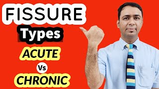 ACUTE FISSURE VS CHRONIC FISSURE  WHAT IS MAIN DIFFERENCE IN TREATMENT OPTIONS [upl. by Richmound]