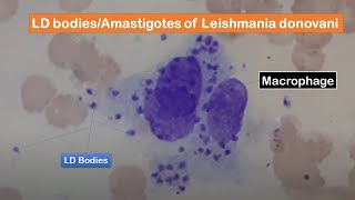 LD bodies Amastigotes of Leishmania donovani in skin smear of a cutaneous leishmaniasis patient [upl. by Emirej805]