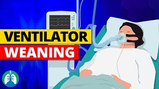 Weaning from Mechanical Ventilation  Criteria and Parameters [upl. by Rehtse]