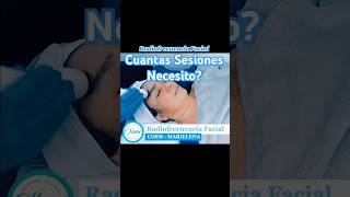 Radiofrecuencia Facial  Rejuvenece tu rostro con éste eficaz tratamiento estetica radiofrecuencia [upl. by Ramedlav]