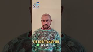 DHI  FUE Hair Transplant  Dr Faisal Hayat Khan  FAestheticsBest Hair Transplant Clinic [upl. by Nodaj820]