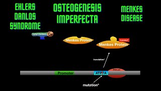 USMLE Step 1  Lesson 23  Osteogenesis Imperfecta Ehlers Danlos Syndrome and Menkes disease [upl. by Emoraj]