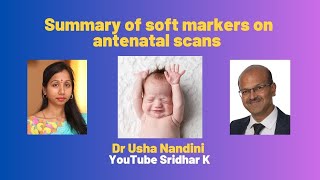 Summary of soft markers on antenatal scans screening pregnancy trisomy softmarkers [upl. by Astera]