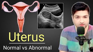 Complete Guide About Uterus Ultrasound by Dr Ali Waqar  Antiverted vs Retroverted Uterus [upl. by Daahsar]