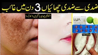 pigmentation treatment on faceChaiyon ka ilaaj tips in UrduVitamin E capsules Chaiya chaiya [upl. by Hasheem452]