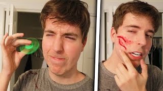 Fidget Spinner Vs Face Legit Had To Get Stitches [upl. by Oirretno]