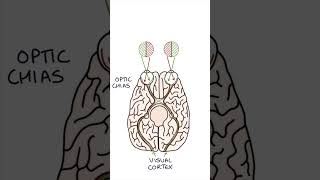 Bitemporal Hemianopia medicine clinicalexamination ophthalmology [upl. by Auoh154]