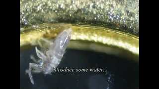 Springtails Under the Microscope [upl. by Onej]