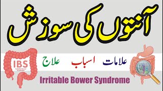 Anton ki sozish ka ilaj  Ibs irritable bowel syndrome  Anton ki sujan or zakhm ka ilaj in urdu [upl. by Enyamrahc]