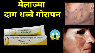 kojivit ultra cream review kojivit ultra gelusesside effects [upl. by Ybanrab]