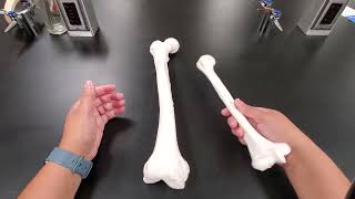 Differences between femur and humerus detailed [upl. by Shane873]