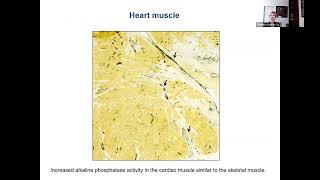 Myositis and Heart Disease with Dr Christina CharlesSchoeman [upl. by Rotkiv]