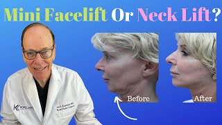 Reasons for a Mini Facelift or Neck Lift Surgery  Plastic Surgeons Opinion [upl. by Letnohc877]