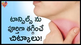 టాన్సిల్స్ ను పూర్తిగా తగ్గించే చిట్కాలు   Best Natural Home Remedies To Cure Tonsillitis  Arogya [upl. by Donovan]