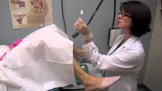 Pap Test  A stepbystep look at what happens during the test [upl. by Mcspadden]