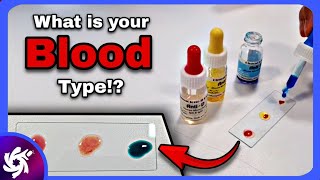 Blood Typing [upl. by Elleoj970]