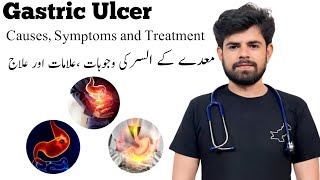 Gastric Ulcer Stomach Ulcer معدے کا السرCauses Symptoms and Treatment Doc Saqi Nishtarian [upl. by Kleon807]