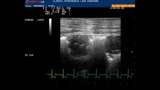 Lung ultrasound 10 MHz linear probe showing subpleural nodular lesions which are the typical probe [upl. by Eduino]