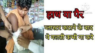 हाथ पैर का प्लास्टर कटाने के बाद में ये करेarmedicalgyan [upl. by Eletnahc]