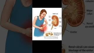 Kidneyfailuremedicalscience growthviralvideotrendingstudents [upl. by Santoro]