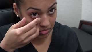 How to Apply Ointment to the Eyes and Eyelids [upl. by Grekin]