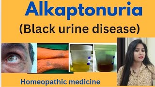 Alkaptonuria Black urine disease treatment  Alkaptonuria symptomscauses amp homeopathic medicine [upl. by Fredericka]