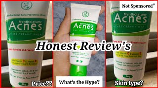 Mentholatum Acne Creamy Face Wash  HONEST REVIEWS ✨ [upl. by Iden]