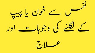 sozak kia hy  sozak ki alamaat  sozak kion hota hy  sozak ki dwa  ik official  health tips [upl. by Enelcaj756]