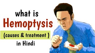 what is Hemoptysis  causes Diagnosis amp Treatment in Hindi hemoptysis [upl. by Anelav335]