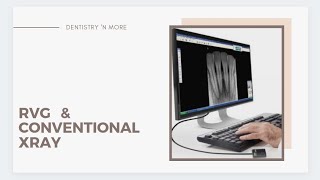 RVG DIGITAL vs CONVENTIONAL XRAY [upl. by Chambers859]