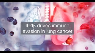 IL1β upregulates immune checkpoint regulators to promote immune evasion in lung adenocarcinoma [upl. by Llewxam980]