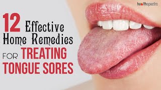 12 Effective Remedies For Treating Tongue Sores  Healthspectra [upl. by Halyahs604]