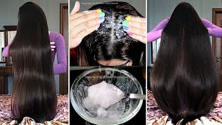 7 Days Extreme Hair Growth Challenge 😱  Worlds Best Remedy for Faster Hair Growth [upl. by Alethia]