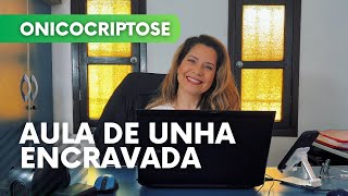 O QUE CAUSA UNHA ENCRAVADA   AULA DE ONICOCRIPTOSE  VIDEO 01 [upl. by Assener310]