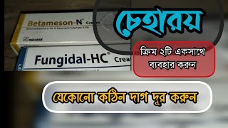 Betameson N Cream amp Fungidal HC Cream ক্রিম দুটি চেহারা পরিষ্কার করার জন্য জাদুর মত কাজ করে [upl. by Nangatrad]