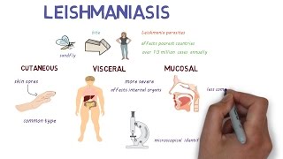 What is Leishmaniasis An introduction and overview [upl. by Gurias]