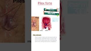 Pilex forte ointment [upl. by Onafets]