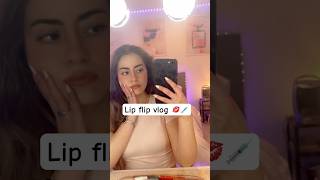 Lip flip botox injections mini vlog and results [upl. by Friedly572]