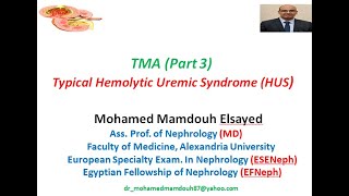 Typical Hemolytic Uremic Syndrome HUS [upl. by Edra]