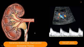 Patología Vascular Renal [upl. by Namien]