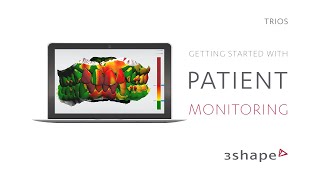 3Shape TRIOS  Getting Started with 3Shape TRIOS Patient Monitoring [upl. by Claude408]