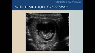 Ultrasound Training Course 09 part 2 [upl. by Astto]