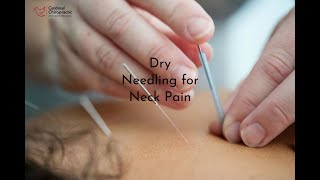 Dry Needling for Neck Pain  Your Burlington NC Chiropractor [upl. by Ybok7]