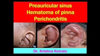 Preauricular sinus  Hematoma of pinna  Perichondritis of pinna  Dr Krishnas ENT Lectures [upl. by Raviv]