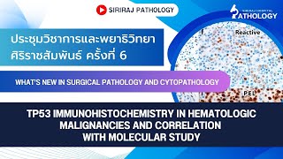 TP53 immunohistochemistry in hematologic malignancies and correlation with molecular study [upl. by Trahurn445]